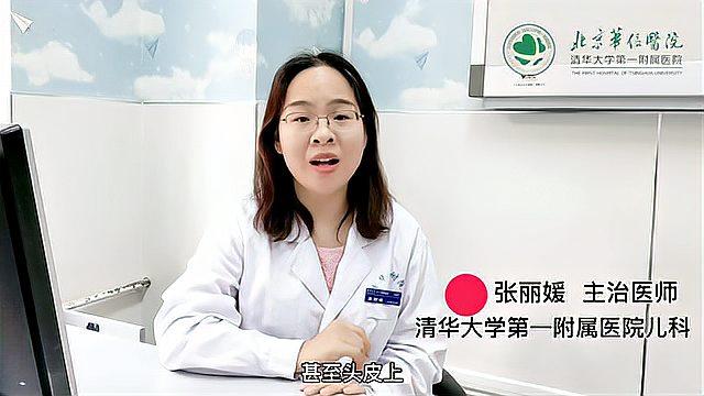 得了幼儿急疹怎么办?其实不用急