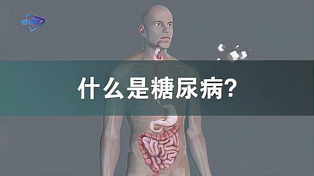一分钟了解什么是糖尿病？