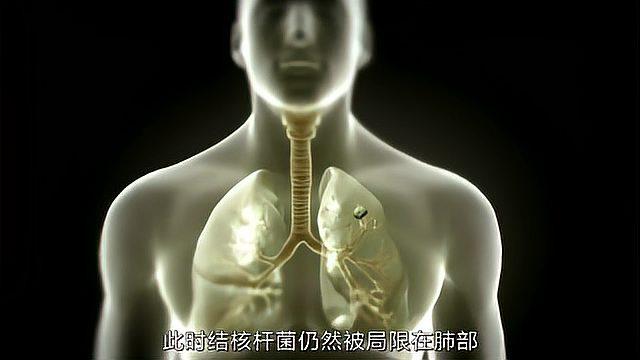 结核的传播与发病机制