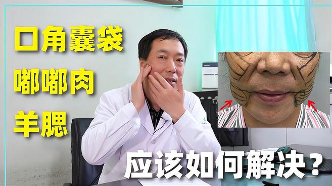 嘟嘟肉、口角囊袋等衰老问题应如何解决?拉皮好还是光纤溶脂好?