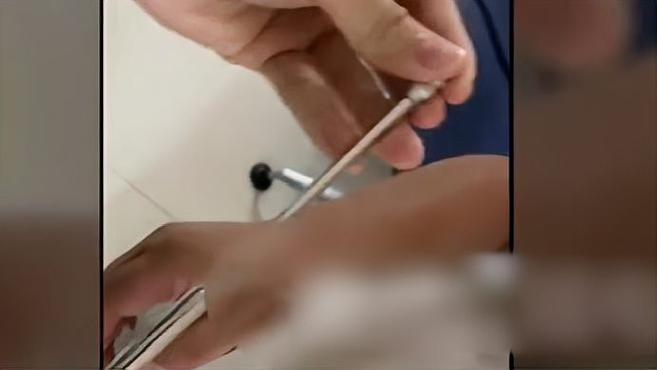 男子射鱼反被误伤,半根鱼镖刺入手掌