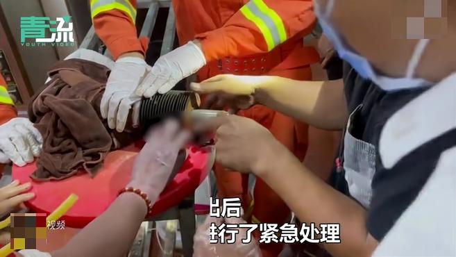 看着都疼!安徽一餐厅女工手卡绞肉机 消防紧急拆卸解救.mp4