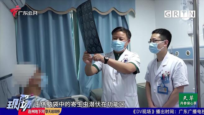 吃蛇肉吞蛇胆喝蛇酒 男子颅内长“懒虫”