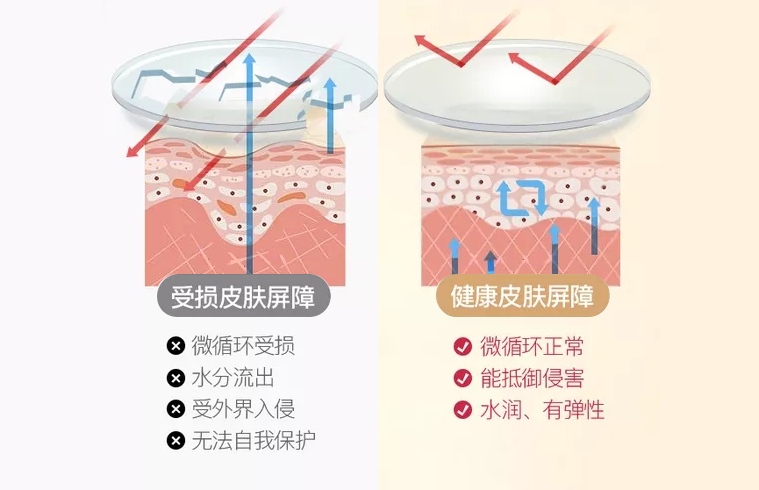 过度清洁,随意刷酸…油痘肌的皮肤屏障真的那么坚固吗