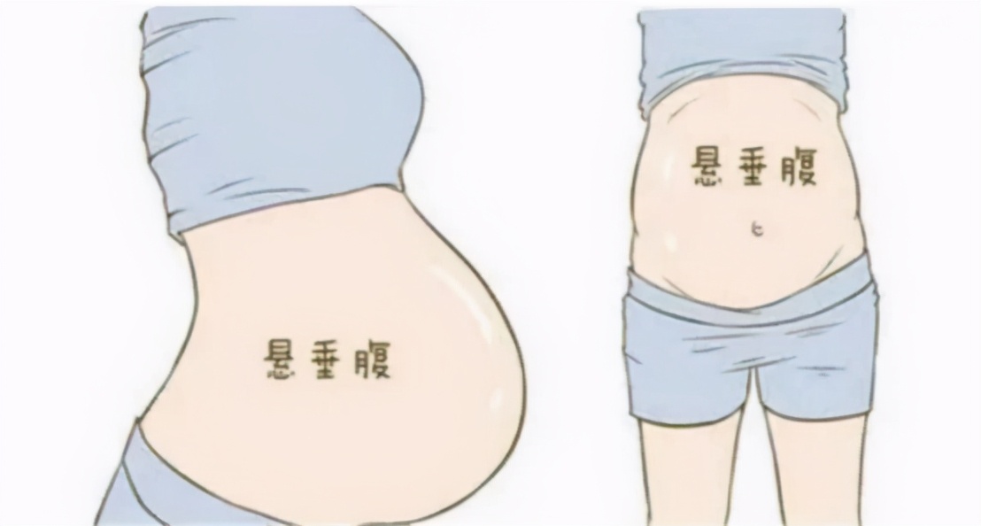 宫缩时肚子的形状图片图片