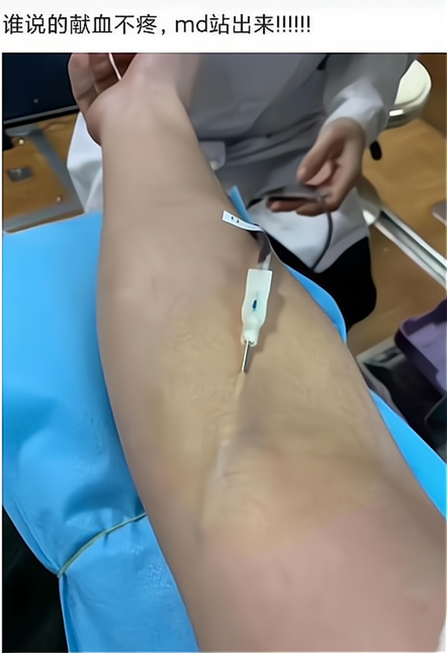 献血要怎么长的针头吗?隔着屏幕的感觉到疼啊!