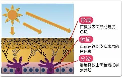 皮膚暗黃長斑?一種