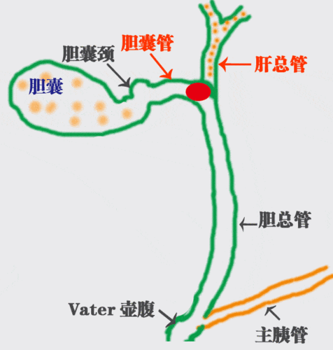 胆囊点的位置图片