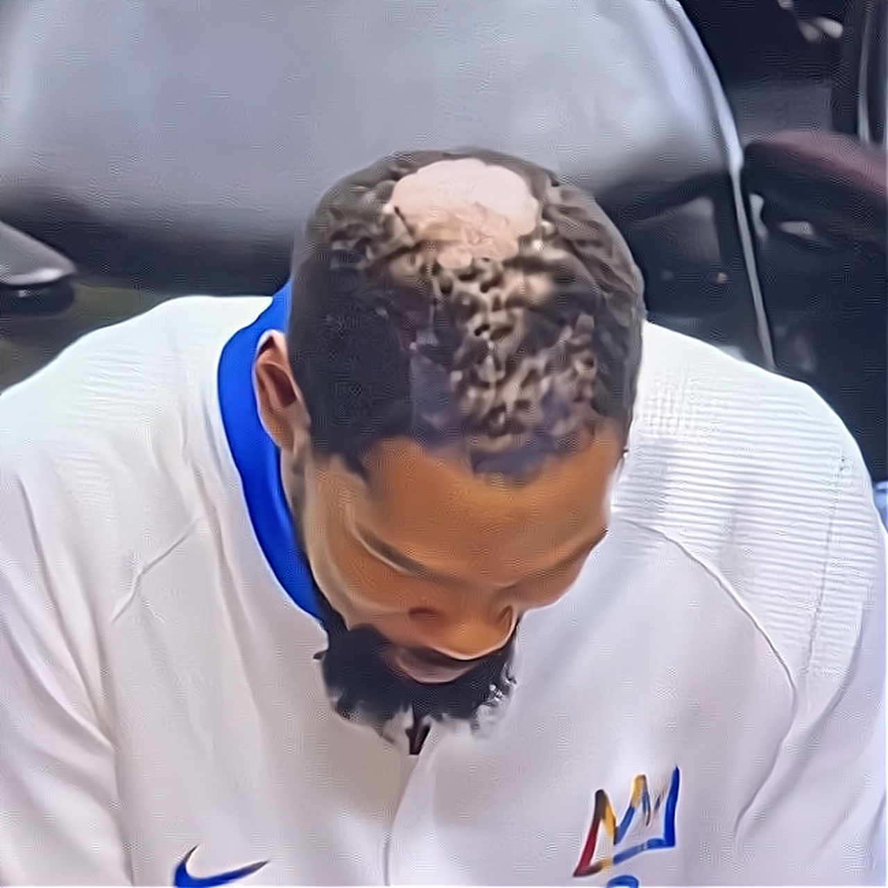 英年早秃!杜兰特头顶照曝光 顶部大面积脱发 #杜兰特