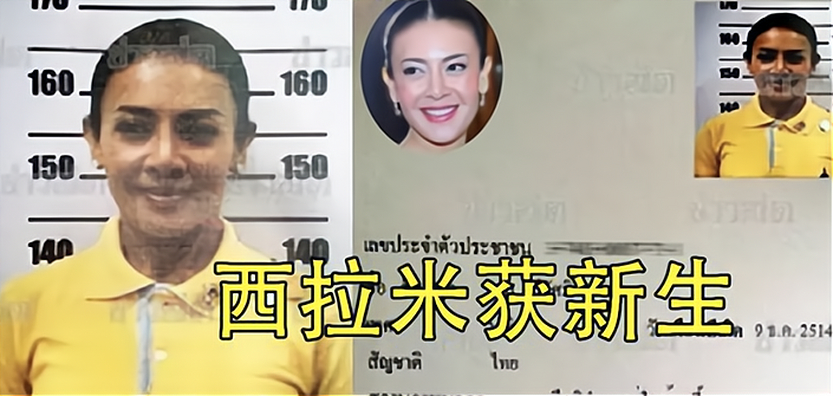 西拉米时隔六年现状首次曝光,身形纤细虚弱,表情仍淡定从容