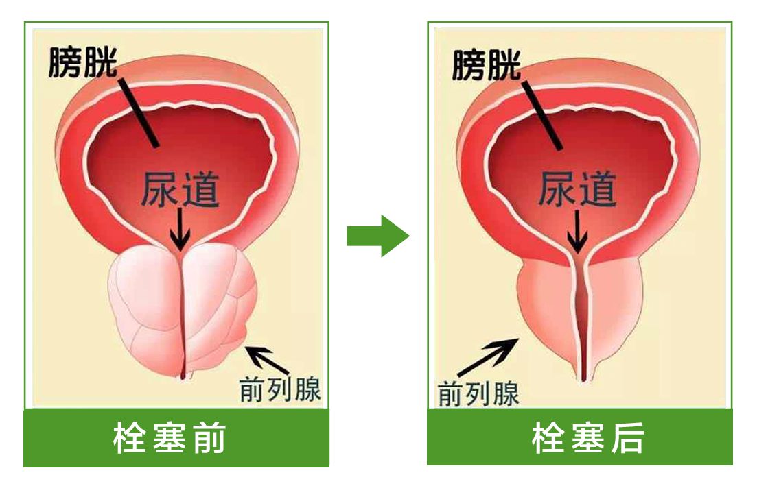 「康復案例」