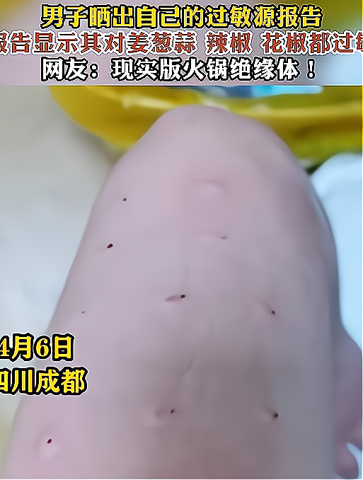 男子晒出自己的过敏原报告报告显示其对姜葱蒜 辣椒 花椒都过敏