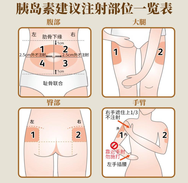 糖尿病打针部位图片