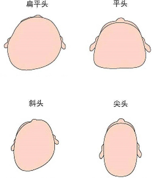 宝宝睡成扁头型