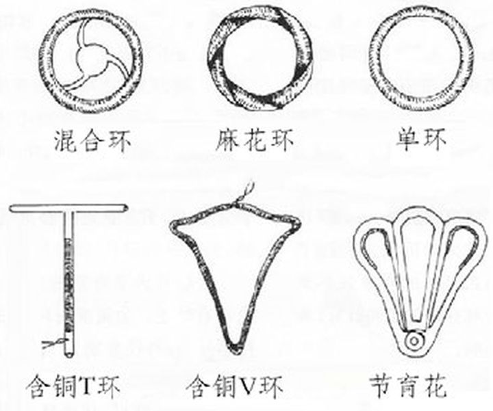 金属节育环图片