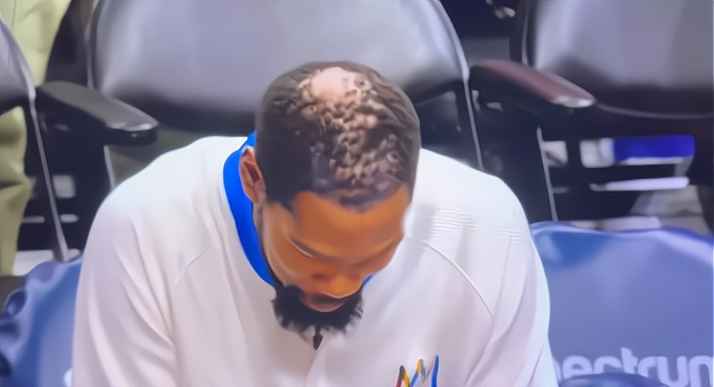 热榜上看到了"杜兰特严重秃顶引热议"的新闻,没想到杜兰特的头顶已经