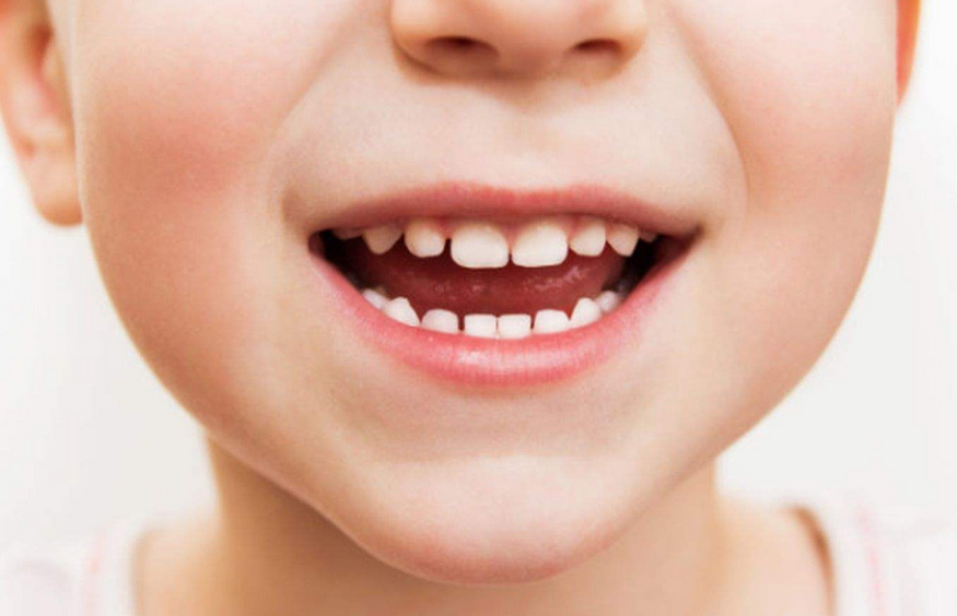 小孩牙齿发黑却并未经常吃糖,真实原因需要注意,刷牙是关键所在