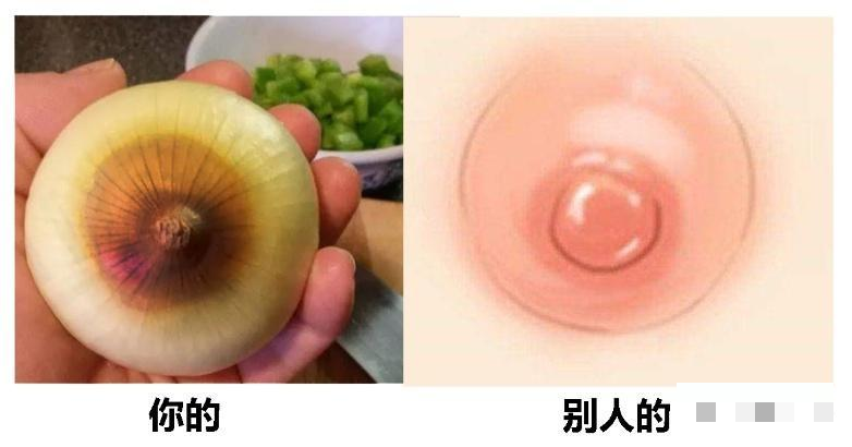 什么是乳晕图片