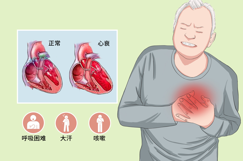 心力衰竭漫画图片