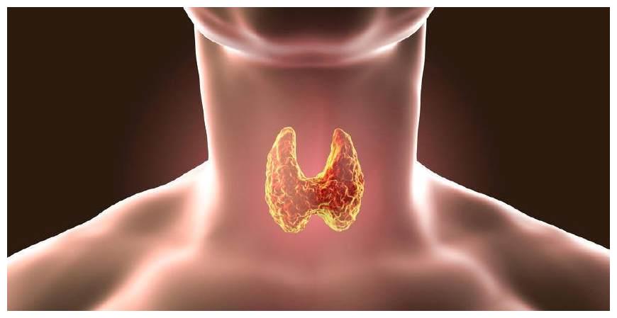 甲状腺结节病根有三