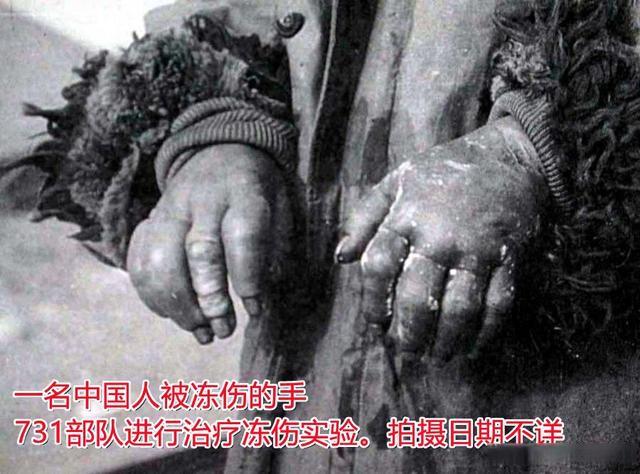 日本731部队在中国实施令人作呕的人体实验计划