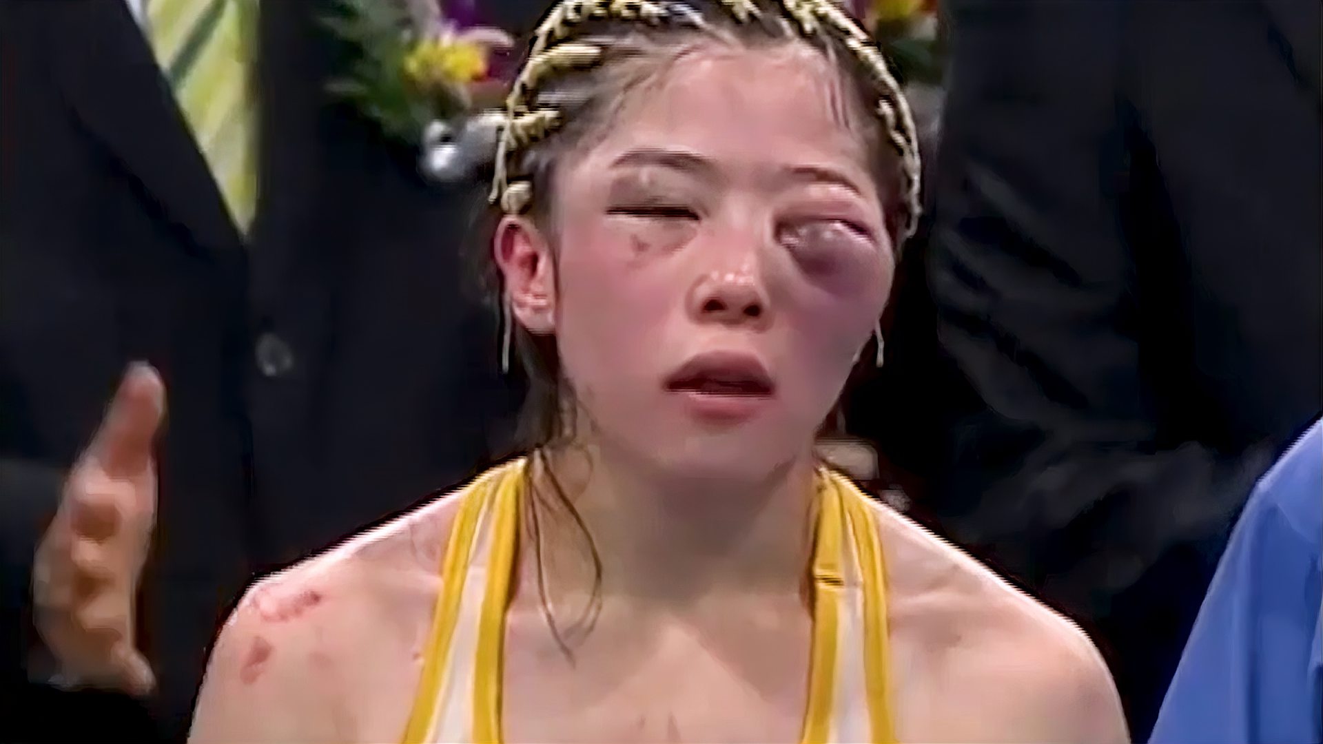 韩国女拳王为捍卫自己的3条金腰带，头顶血包奋战，台下母亲哭了