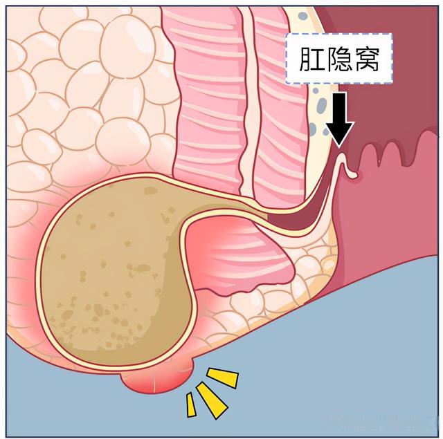 肛窦位置图图片