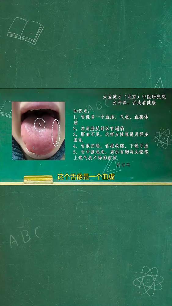 舌象分析:气虚,血瘀的舌象讲解,健康养生,健康常识,好看视频