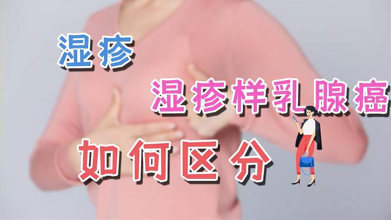 乳房发痒起疙瘩看着像quot湿疹quot也可能是湿疹样乳腺癌的迹象