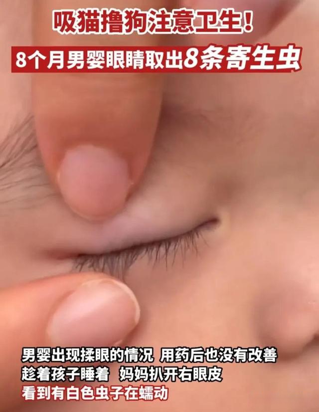 小孩眼睛有虫子图片图片