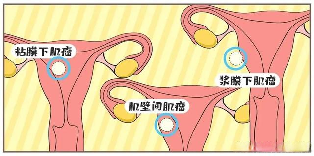 10岁子宫图片