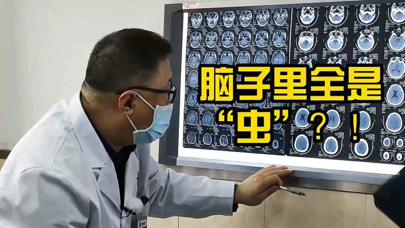 男子得脑囊虫病脑子里全是虫医生建议去防疫站检测活性