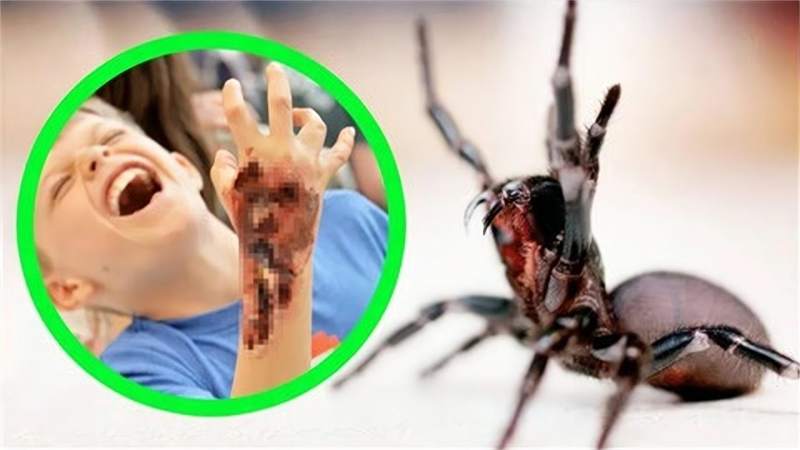 盘点世界上最毒的4种蜘蛛被蜘蛛咬伤身体会发生什么