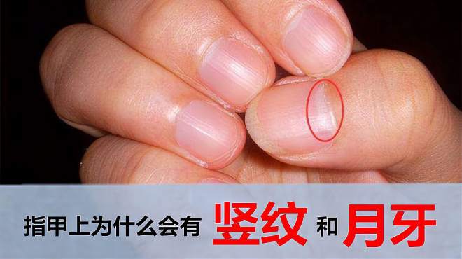 为什么指甲上有竖纹和月牙?看了指甲结构,终于解开了心中的困惑