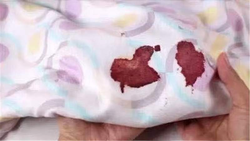 不管床单血渍多难洗,用上这个方法,简单搓一搓,血渍立马去除!,生活,生活技巧,好看视频