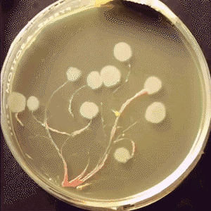 金色葡萄球菌的克星图片