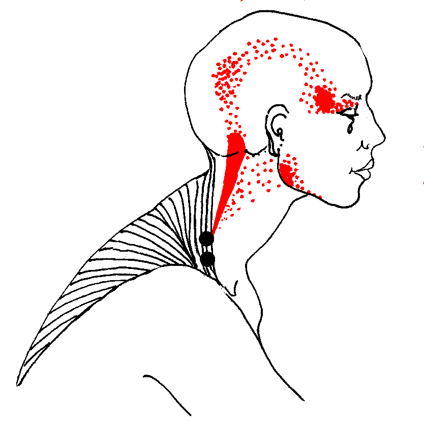 颈椎疼,上斜方肌有问题?找一把椅子,一个动作让你拥有天鹅颈