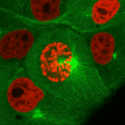 马达蛋白囊泡图片